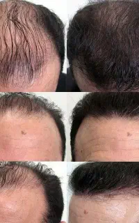 وقتشه دوباره به موهای پرپشتت سلام کنی