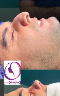 جراحی زیبایی بینی  نقد و اقساط