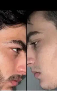 پرپشتی ریشات فقط دست منه