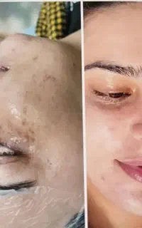 فیشال برند امریکا