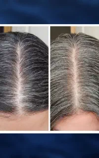 با حذف سفیدی سنتو بیار پایین