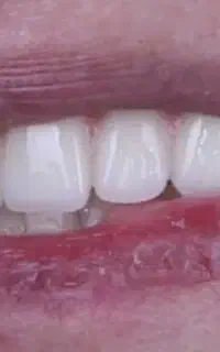 جشنواره کامپوزیت با قیمت مناسب فقط به مدت 3 را روز