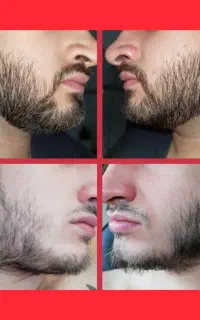عامل پر پشتی ریشات دست منه
