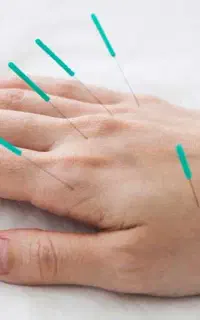 کلینیک طب سوزنی ـ سنتی سینا