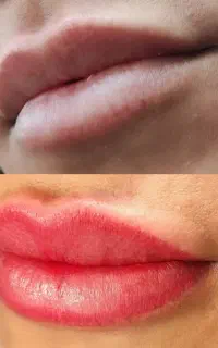 میکرو،شیدینگ ،بن مژه ،ریموو،خط چشم