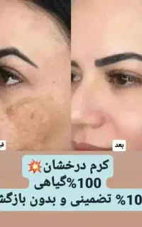 زیبایی و‌اعتماد به نفس حق شماست با کرم درخشان
