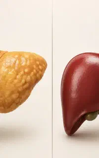 کبد چرب مرگ خاموش بدن