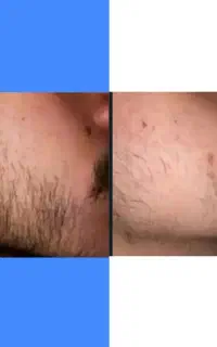 چرا همه دارن سمت این روش میان
