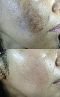 ضدلک لاکچری کوین