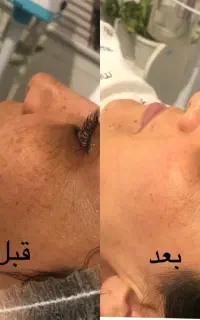فشیال تخصصی