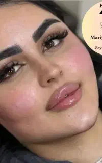 جشنواره تزریق ژل و بوتاکس توسط پزشک متخصص