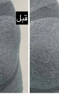 آف یک هفته تزریق دست باسن و بیکینی خانم دکتر ذهابی
