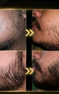 برای همه سنی مناسبه و پرپشت میکنه