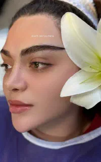 جشنواره کاشت مو و ابرو با و بدون جراحی