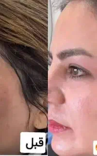 کرم ضد لک بیوممتیک ایتالیایی