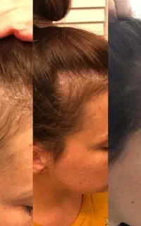 هنوزم فکر می‌کنی برای رویش راهی نیست