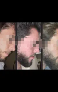 ۳۰ روزه پرپشت میشه