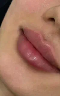 تخفیف ۳۰درصدی کلینیک آرایAray