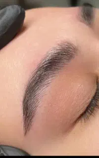 فیبروز ابرو فقط هزینه مواد