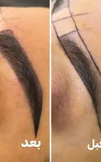 بازاریاب و بیمار یاب کلینیک زیبایی