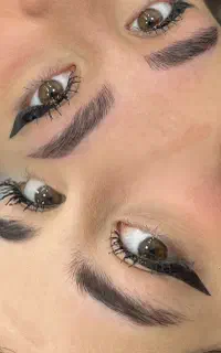 میکروبلیدینگ اقتصادی