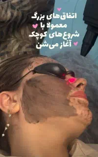 فیشال ،پاکسازی و خالبرداری
