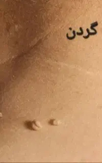 جشنواره حذف تاتو برداشت خال درمطب(آقایان،خانومها)