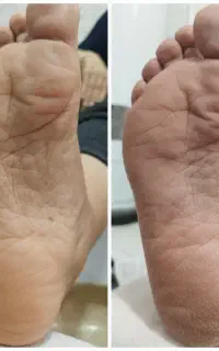 پدیکور تخصصی