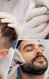 آموزش تخصصی کاشت مو،ابرو،ریش،مزو و پی آرپی