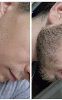 در بیار ریش و سبیلتو .۳۲ روزه تضمینی