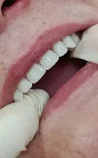 لابراتوار دندانسازی کیمیا                  اقساطی