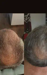 این اقدام آخریشه
