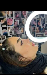 عمل بینی و تمام عمل های زیبایی