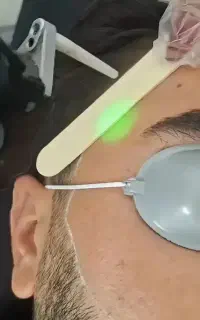 جشنواره تخفیفی لیزر دکا