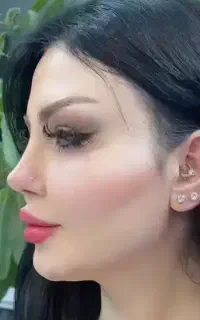 تخفیف عمل بینی لیپوابدو لیفت صورت سینه پیکر تراش