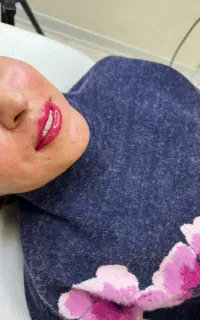 رفع تیرگی لب بانوان و اصلاح تناژ لب