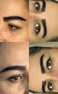 کاشت طبیعی و دائمی ابرو