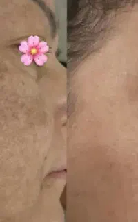 پوست زیبا داشته باش