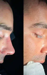 اهواز)  آف جراحی بینی ۲۵