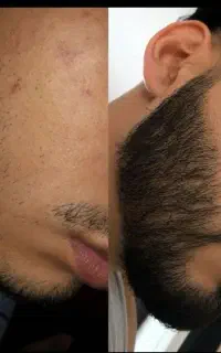 مثل چمن پرپشت میشه