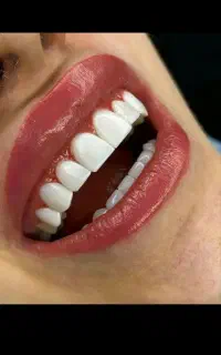 کامپوزیت از دم قسط