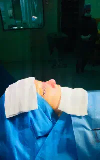 جراحی بینی بدون تامپون در رشت (عمل بینی)