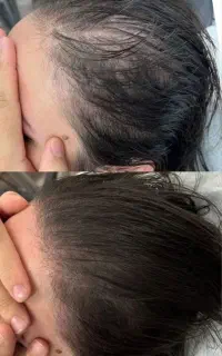کاشت ممنوع