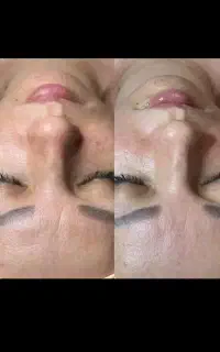تاتو دائم، فیشیال، اسپا، کراتین،خالبرداری