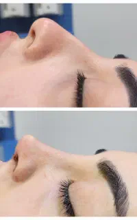 عمل بینی ۴۹ تومن