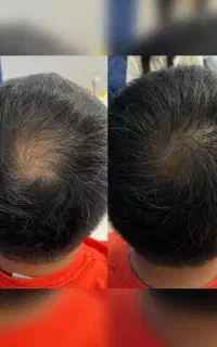 پیش ما کم پشتی ممونوعه
