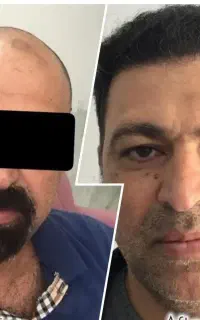 کاشت طبیعی و پرتراکم