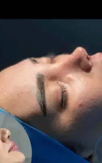 آف 30 درصدی جراحی بینی در اهواز