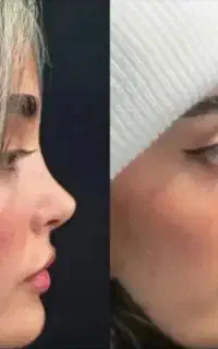 عمل بینی با تعرفه دولتی