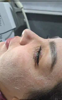 پاکسازی زیبایی پزشکی همیشه تخفیف/ آقایان و بانوان/